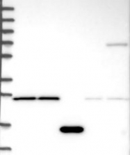 NBP1-89378 - DHRS9
