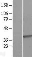 NBL1-09873 - DHRS9 Lysate