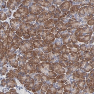 NBP1-85219 - DHRSX