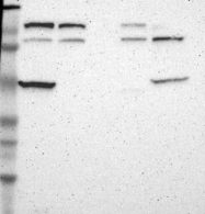 NBP1-85217 - DIAPH2