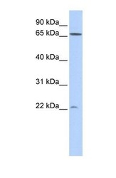 NBP1-58888 - DIRAS1