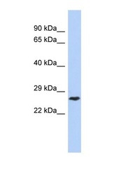 NBP1-58935 - DIRAS1