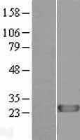 NBL1-09889 - DIRAS1 Lysate