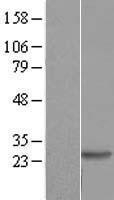 NBL1-09890 - DIRAS2 Lysate