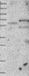 NBP1-85156 - DKC1 / NOLA4