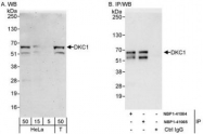 NBP1-41064 - DKC1 / NOLA4