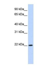 NBP1-55201 - DPCD