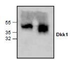 NBP1-45519 - Dickkopf-1