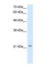 NBP1-59321 - Dickkopf-1