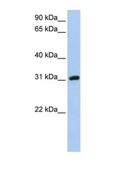 NBP1-69688 - Dickkopf-like protein 1