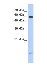 NBP1-54949 - DYNLL1