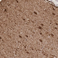 NBP1-82987 - DLG5