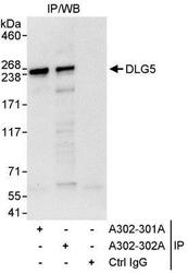 NBP1-28694 - DLG5