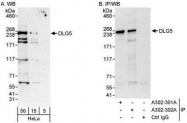 NBP1-28739 - DLG5