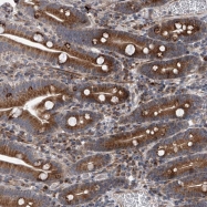 NBP1-90602 - DLGAP2