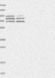 NBP1-90602 - DLGAP2