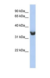 NBP1-62421 - DLK1
