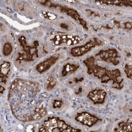 NBP1-86413 - Delta-like protein 4 / DLL4