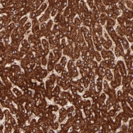 NBP1-85012 - DLST / DLTS