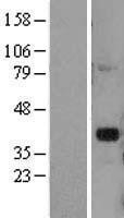 NBL1-09917 - DLX2 Lysate