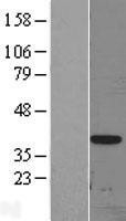 NBL1-09918 - DLX3 Lysate