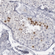 NBP1-82838 - DMC1 / LIM15