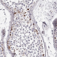 NBP1-84071 - DMRT1