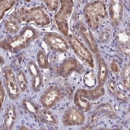 NBP1-91838 - DMRTA1 / DMO