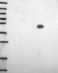 NBP1-91838 - DMRTA1 / DMO