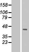 NBL1-09926 - DMRTC2 Lysate