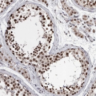 NBP1-84073 - DMTF1 / DMP1