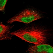 NBP1-87720 - DNA ligase 3