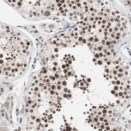 NBP1-87720 - DNA ligase 3