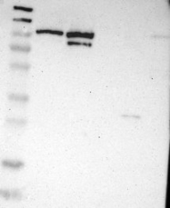 NBP1-87720 - DNA ligase 3