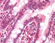 NB100-1358 - DNA polymerase lambda