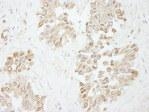 NB100-81665 - DNA polymerase lambda