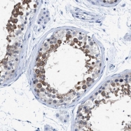 NBP1-84465 - DNAI1