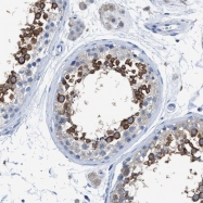 NBP1-84466 - DNAI1