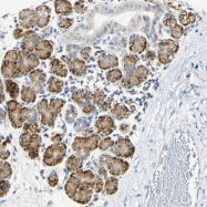 NBP1-85208 - DNAJB12