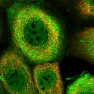 NBP1-81736 - DNAJB4 / HSP40 homolog
