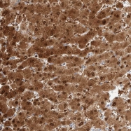 NBP1-82624 - DNAJB6