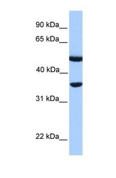 NBP1-54951 - DNAJB6