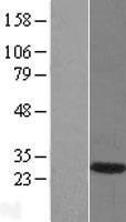 NBL1-09941 - DNAJB6 Lysate