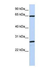 NBP1-69608 - DNAJC1 / HTJ1