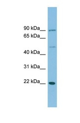 NBP1-57718 - DNAJC12 / JDP1