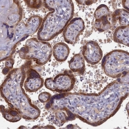 NBP1-84613 - DNAJC17