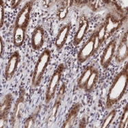 NBP1-84614 - DNAJC17