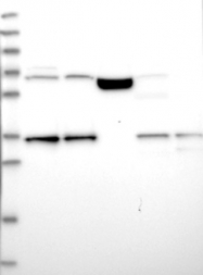 NBP1-84613 - DNAJC17