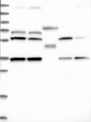 NBP1-84614 - DNAJC17
