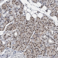 NBP1-81507 - DNAJC6